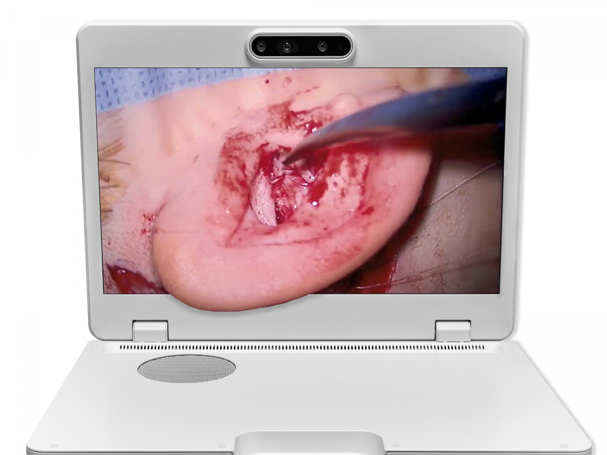 达擎之＂Heads-up 3D显微手术显示系统＂，整合4K裸眼3D显示及眼球追踪系统，具备快速追踪人眼移动位置功能，减轻医师长时间维持固定姿势的负担，让医师能有更宽广清晰的3D立体视野及更舒适的姿势来执行手术。